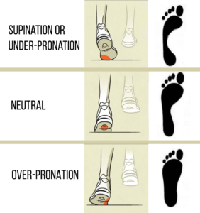 foot pronation in runners